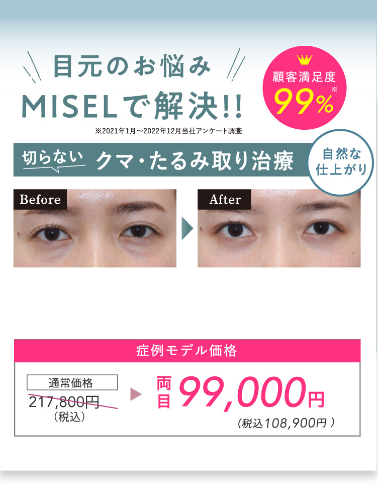 目元のお悩みMISELで解決