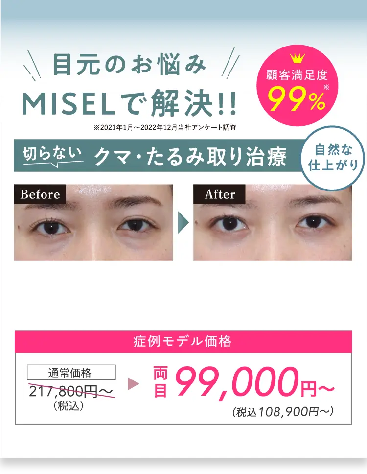 目元のお悩みMISELで解決