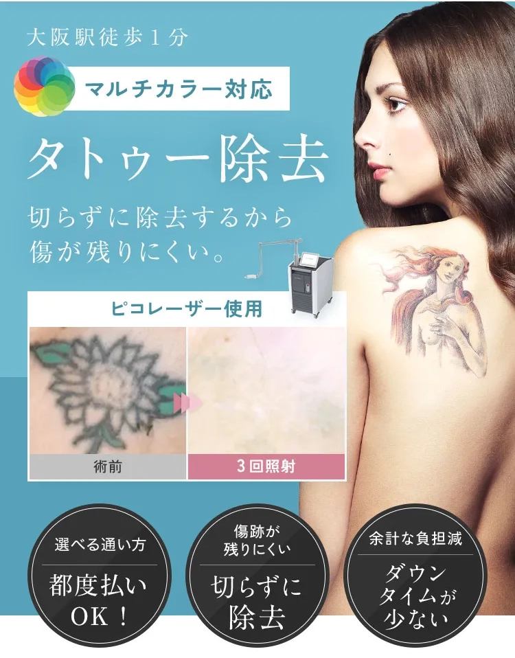 大阪駅から徒歩1分 マルチカラー対応　タトゥー除去 切らずに除去するから傷口が残りにくい