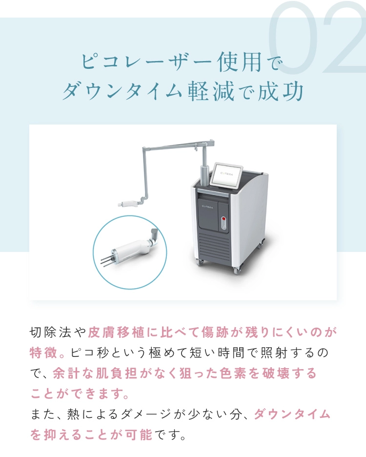 ピコレーザー使用で ダウンタイム軽減で成功