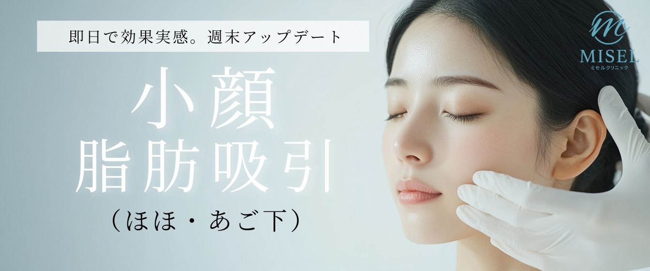 ミセルクリニック大阪梅田院 即日で効果実感。週末アップデート 小顔脂肪吸引（ほほ・あご下）
