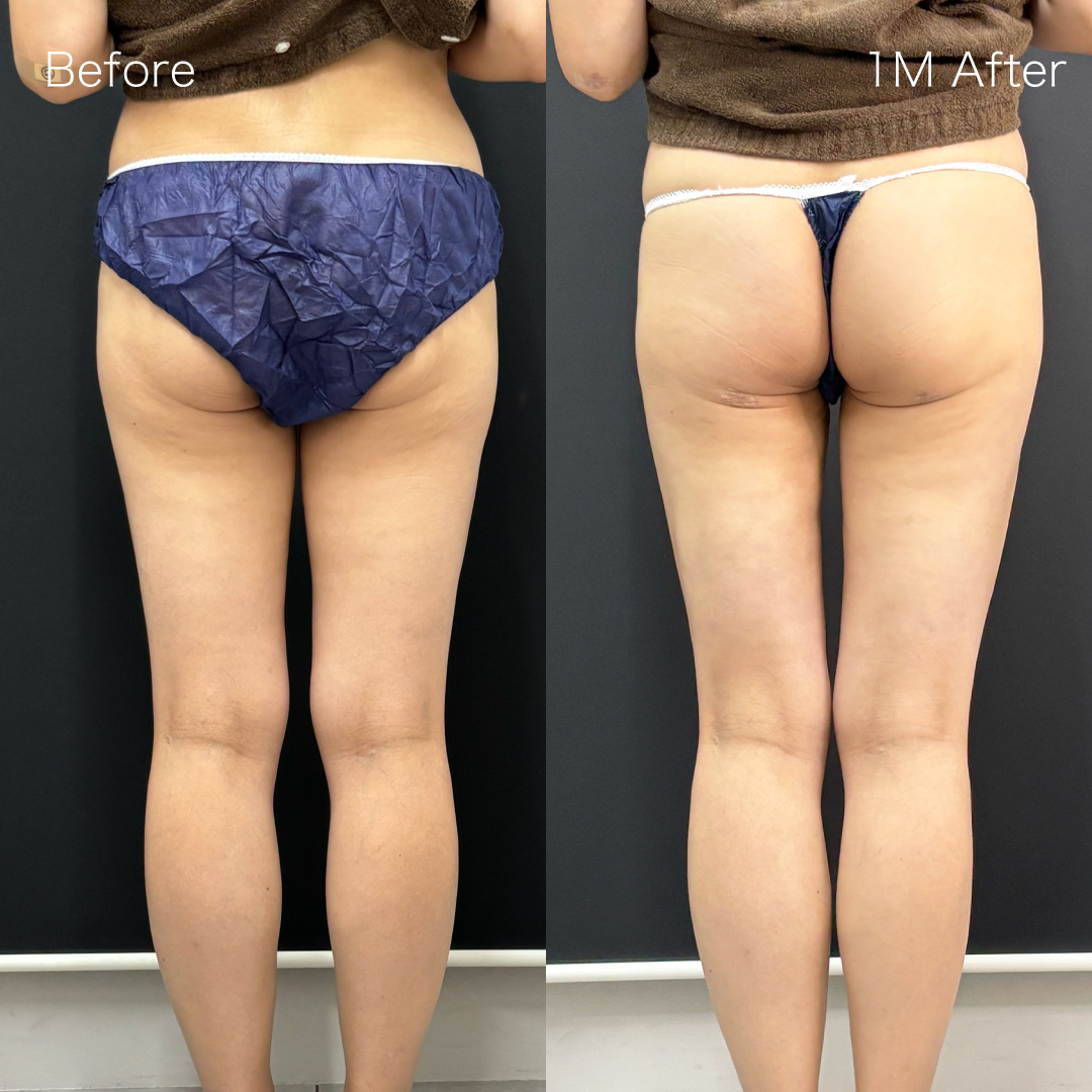 身体の症例の症例画像