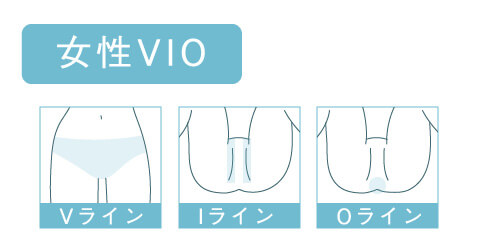 VIO医療脱毛の女性イラスト