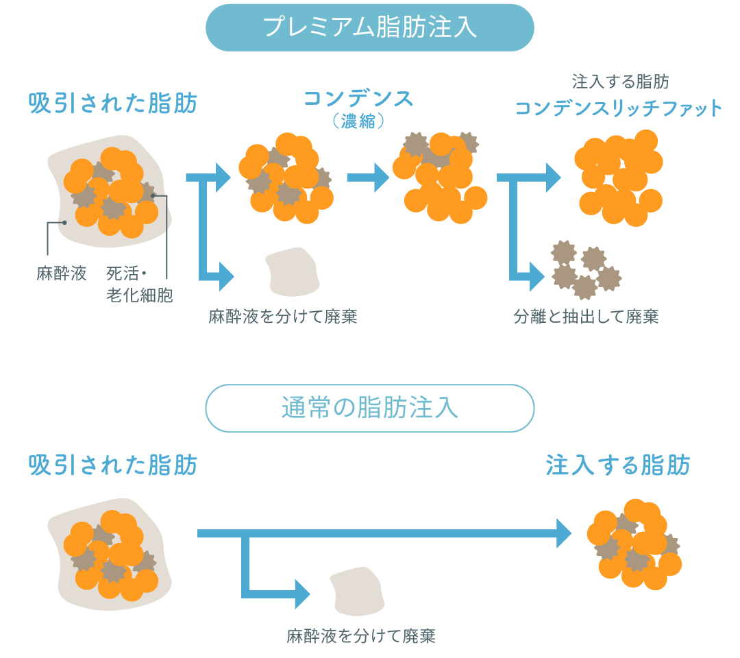 セルクリニック大阪梅田院 コンデンスリッチファット(CRF)のイメージ
