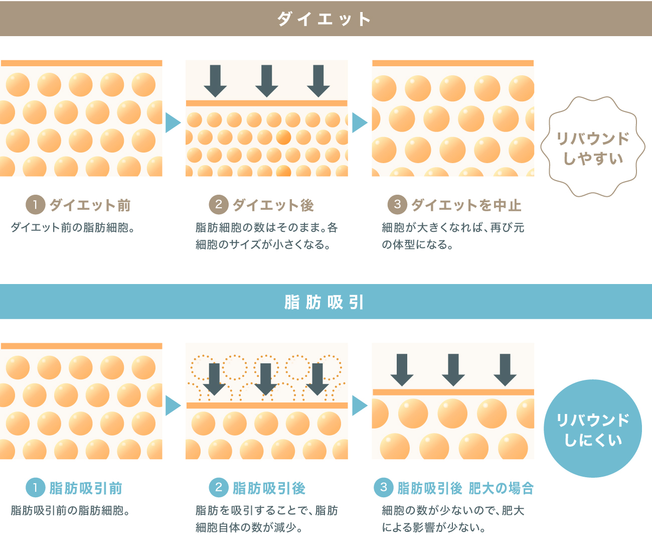 ミセルクリニック大阪梅田院の脂肪吸引がリバウンドしにくい理由