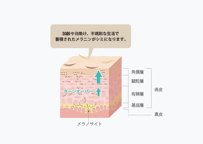 シミはなぜできるのか?