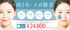 ただおかメディカルクリニック（岸和田院）の炭酸ガスレーザーによるほくろ除去バナー